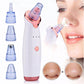 Multifunction Diamond Microdermabrasion Beauty Device / Blackhead and Acne Vacuum Cleaner - 