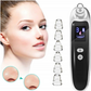 Blackhead vacuum cleaner + 6 interchangeable attachments – 